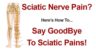 TOP 10 MOST EFFECTIVE EXERCISES FOR SCIATICA PAIN