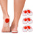 Gel Heel Cups Plantar Fasciitis Inserts 3 x Pairs