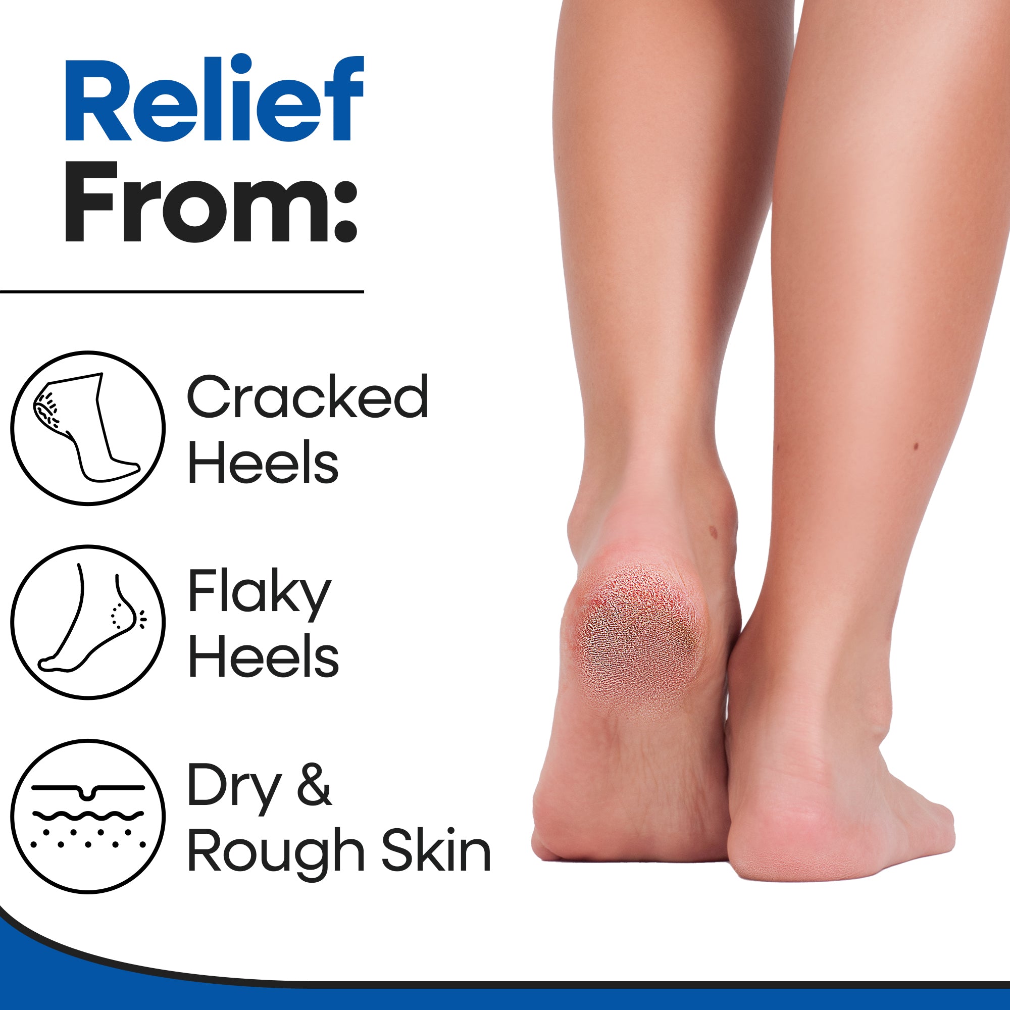 Moisturizing Heel Socks & Cracked Heel Treatment (3 Pairs)