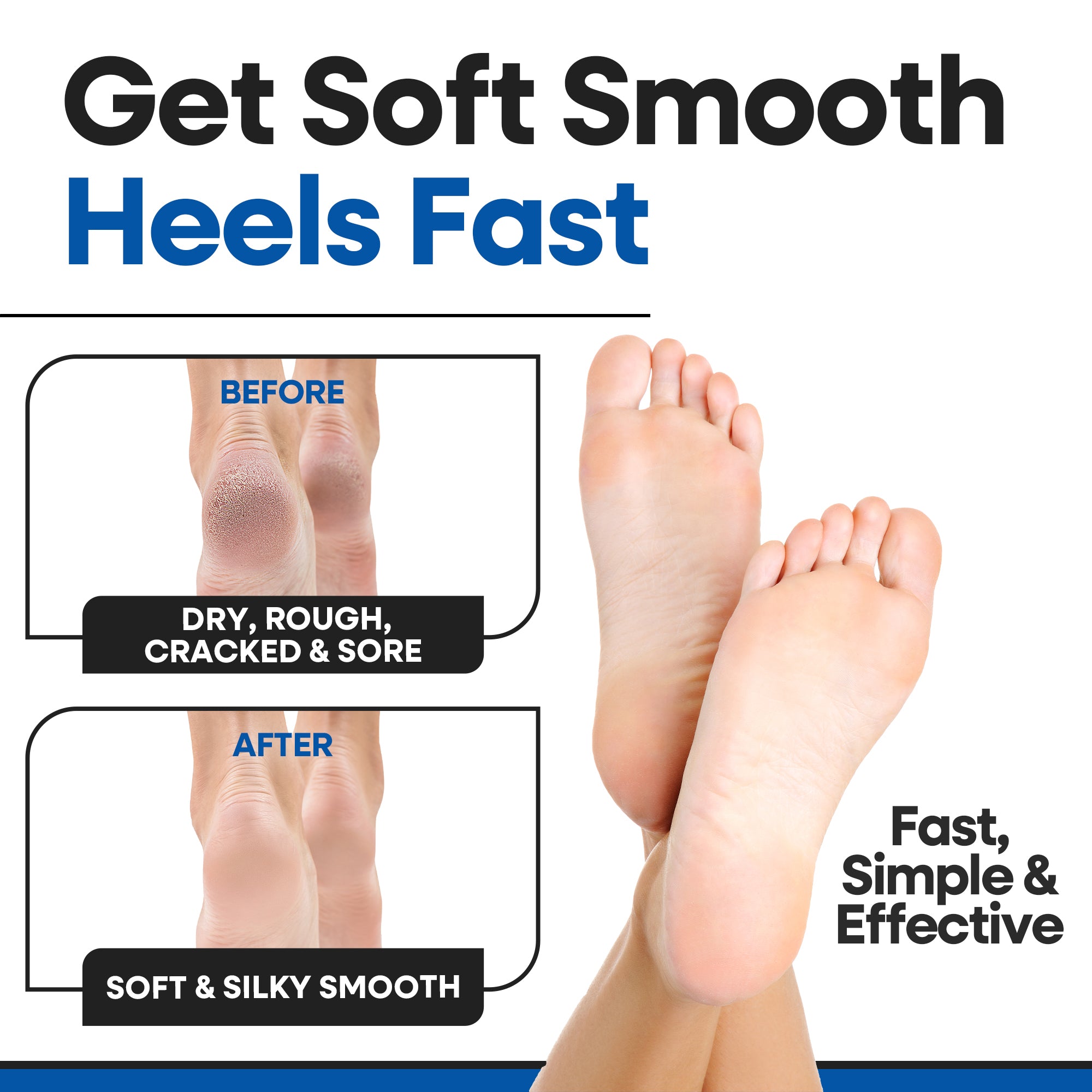 Moisturizing Heel Socks & Cracked Heel Treatment (3 Pairs)
