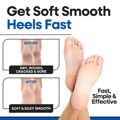 Moisturizing Heel Socks Cracked Heel Treatment (3 Pairs)